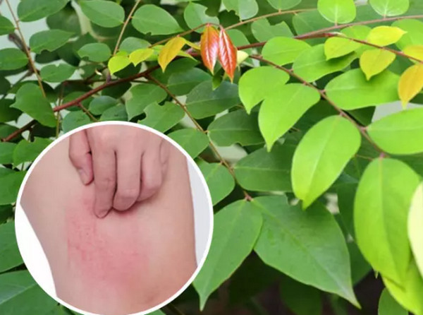 Tắm lá khế chua có chữa được mày đay không? Lưu ý an toàn