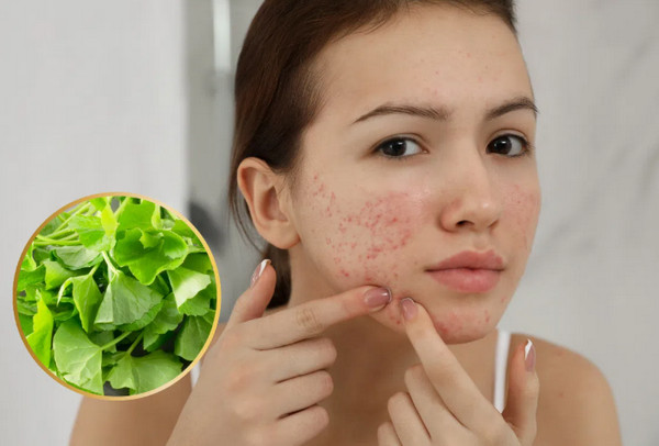 Tinh chất rau má là gì, có tác dụng gì với da