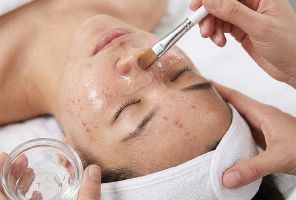 5 hoạt chất peel da nguồn gốc thiên nhiên, an toàn cho da