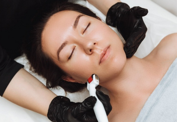 Lăn kim trị lỗ chân lông to: Ưu điểm và lưu ý