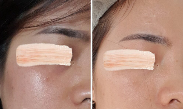 Thành phần phục hồi da trong kem dưỡng và cách sử dụng hiệu quả