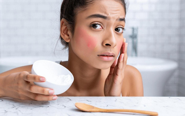 Trị mụn bằng baking soda: Lợi ích, rủi ro và cách sử dụng an toàn